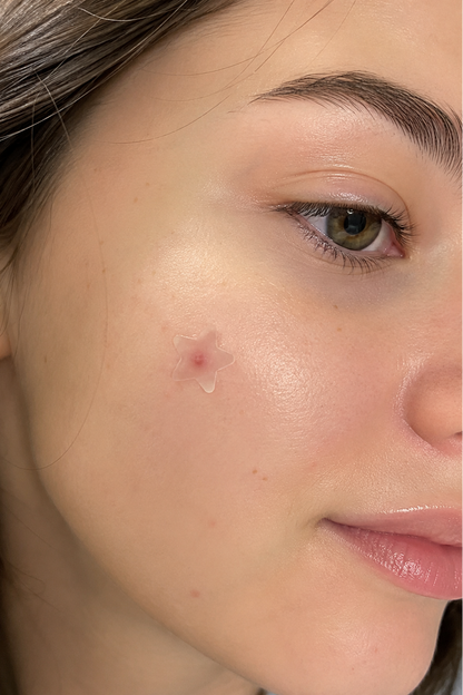Elorine Glow™ Pimple Patches